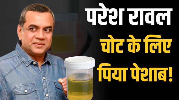 परेश रावल बोले- घुटने की चोट के लिए पिया पेशाब