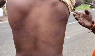 छिंदवाड़ा में आदिवासी युवक ने ढाबा संचालक पर लगाए आरोप, बोला- उसके मुंह पर थूका, मारा और पेशाब पिलाई