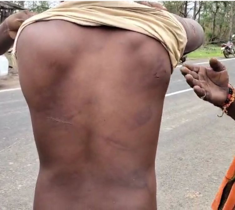 छिंदवाड़ा में आदिवासी युवक ने ढाबा संचालक पर लगाए आरोप, बोला- उसके मुंह पर थूका, मारा और पेशाब पिलाई