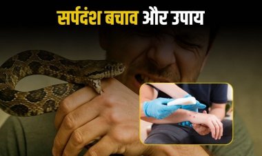 मुख्य चिकित्सा एवं स्वास्थ्य अधिकारी ने दी सर्पदंश से बचाव एवं उपचार की जानकारी