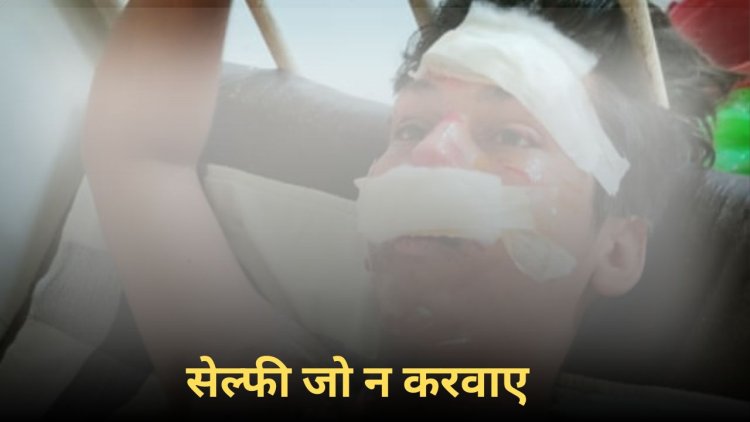 सेल्फी के चक्कर में हाई वोल्टेज की चपेट में आया युवक, बालबाल बची जान