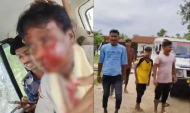 बंगाल के जलपाईगुड़ी में बाढ़ पीड़ितों को राहत सामग्री बांटने गए भाजपा सांसद पर हमला, सिर फूटा