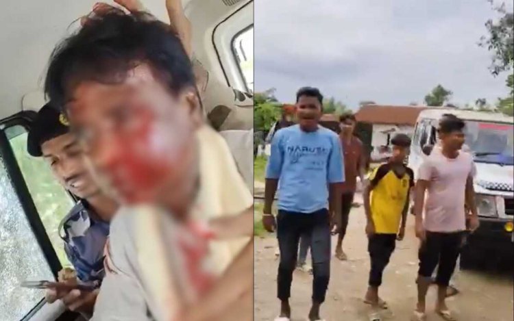 बंगाल के जलपाईगुड़ी में बाढ़ पीड़ितों को राहत सामग्री बांटने गए भाजपा सांसद पर हमला, सिर फूटा