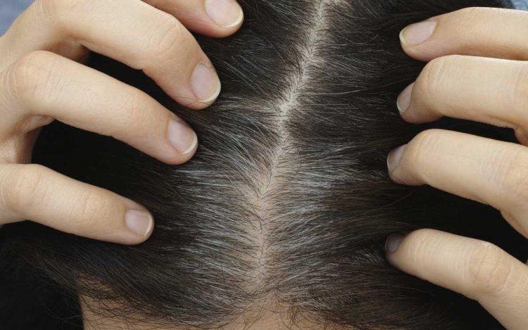 क्या सफेद बाल तोड़ने से बढ़ते हैं? जानिए सच्चाई और उपाय