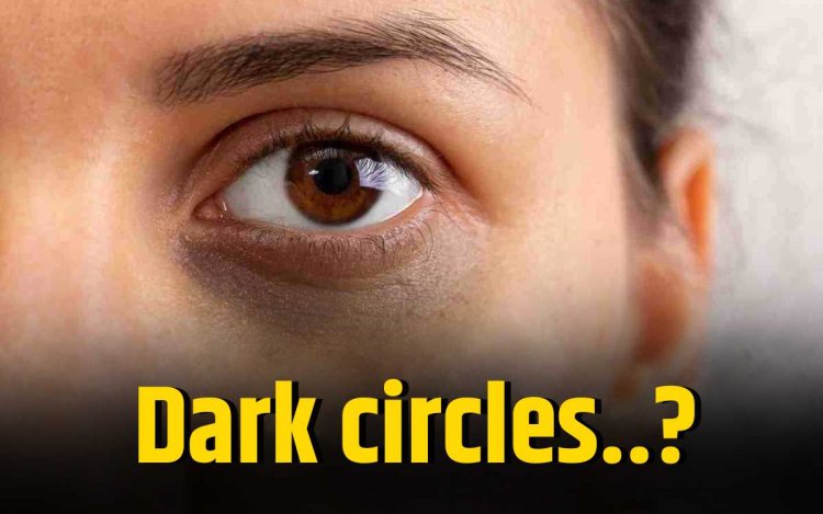 Dark Circles से 1 हफ्ते में पाएं छुटकारा, आजमाएं ये आसान टिप्स