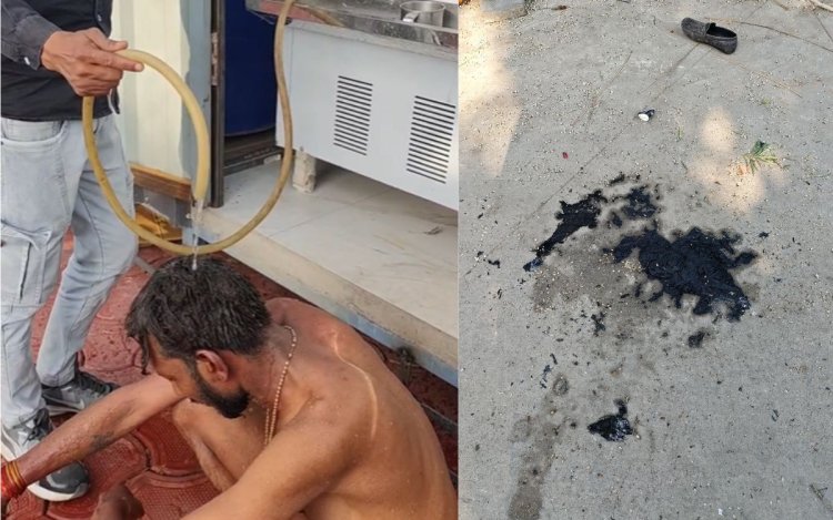 Bhopal: 10 नंबर मार्केट में व्यापारी ने खुद को लगाई आग