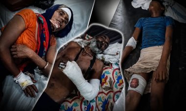घर के आंगन में नहाते समय जंगली सुअर ने किया हमला, मां-बेटा-बेटी समेत 4 घायल