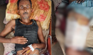 मऊगंज में जंगली सूअर का कहर, बगीचे में रखवाली कर रहे किसान पर हमला, हालत गंभीर रीवा रेफर