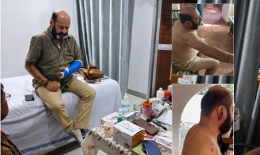 नागौद राजघराने गोलीकांड में नया खुलासा: फायरिंग से पहले हुई बाबा राजा की जमकर पिटाई