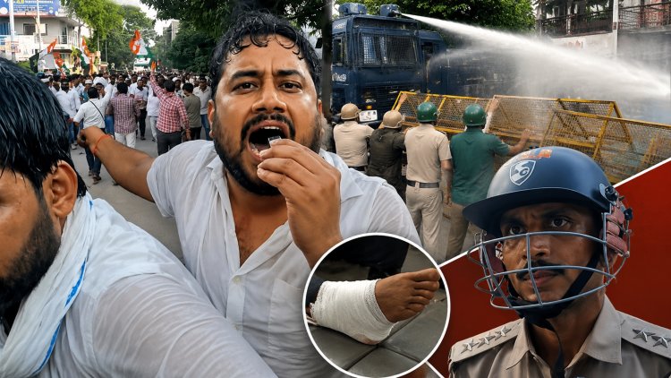 सतना में भाजपा दफ्तर घेरने पहुंचे युवा कांग्रेस कार्यकर्ता, वाटर कैनन के बीच अध्यक्ष वरुण गुर्जर का पैर टूटा