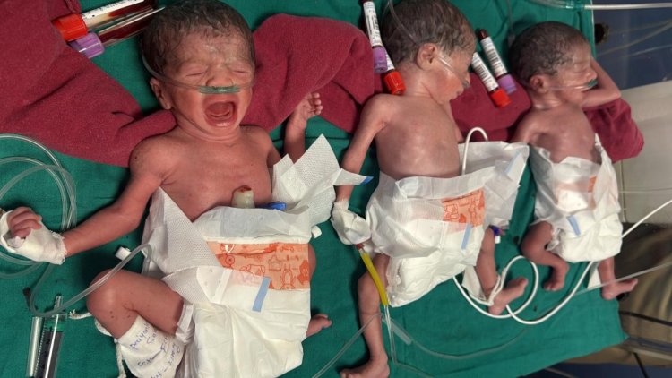 चिकित्सकों ने कराई 7 माह गर्भवती की सामान्य डिलीवरी एक साथ तीन बेटियों को दिया जन्म