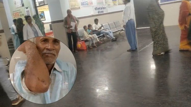 Mauganj में पागल कुत्ते का आतंक, दो घंटे में 16 लोगों को काटा; गांव में दहशत