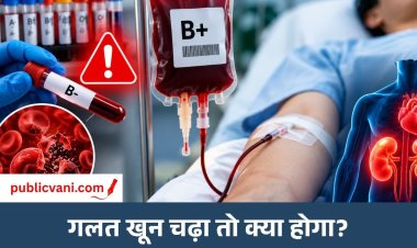 Health Alert : मरीज को गलत ब्लड ग्रुप का खून चढ़ जाए तो क्या होगा? इन लक्षणों को भूलकर भी न करें नजरअंदाज