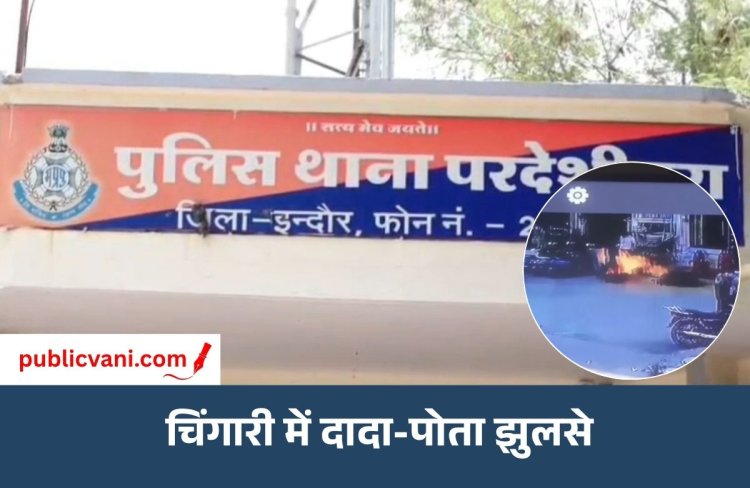 इंदौर में पायरो फ्लेम मशीन से निकली चिंगारी: दादा-पोता झुलसे, इवेंट संचालक तुषार पर केस दर्ज