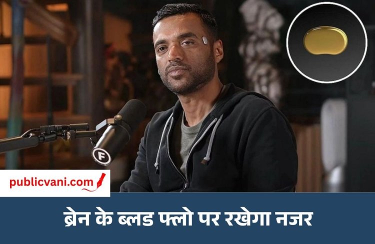 New Fitness Gadget : माथे पर चिपकने वाला फिटनेस गैजेट आ गया, 1 नवंबर से शुरू होगी प्री- बुकिंग